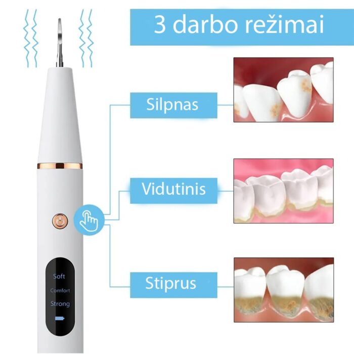 ultragarsinis-dantu-valymo-rinkinys-6.jpg